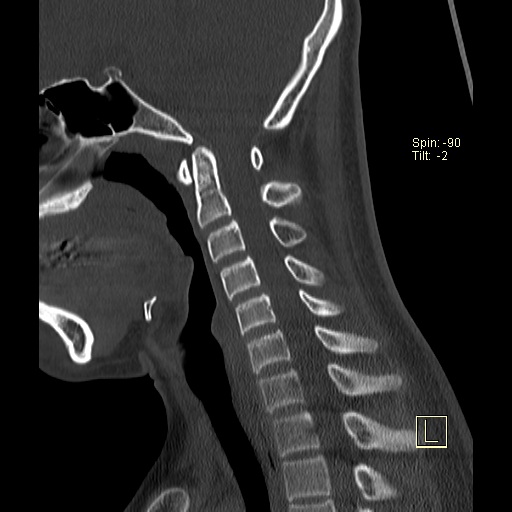 normal ct