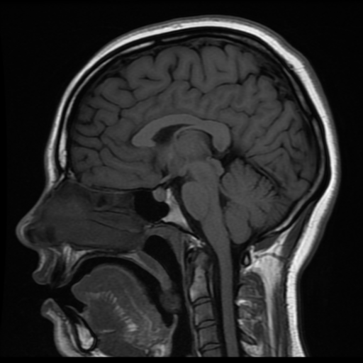 normal mri
